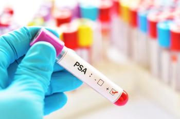 blood sample positive with psa prostate cancer © jarun011 - stock.adobe.com