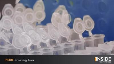 Inside the Practice: Inside New Technology to Detect Melanomas