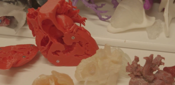 A 3D printed model of a heart. 