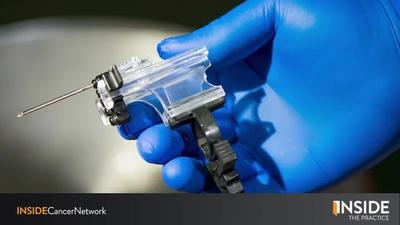 Inside the Practice: Inside Transperineal Prostate Biopsies
