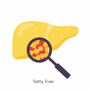 Pegozafermin for Nonalcoholic Steatohepatitis 