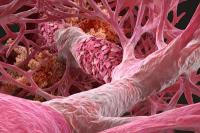 pink-colored image of fibrotic lung tissue | image credit ©ckybe stock.adobe.com
