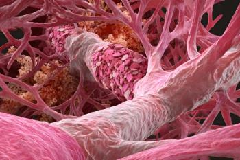 pink-colored image of fibrotic lung tissue | image credit ©ckybe stock.adobe.com
