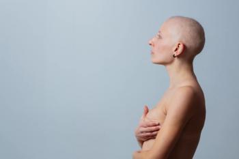 sideview of a woman are mastectomy| image credit: ©Sergey Novikov
