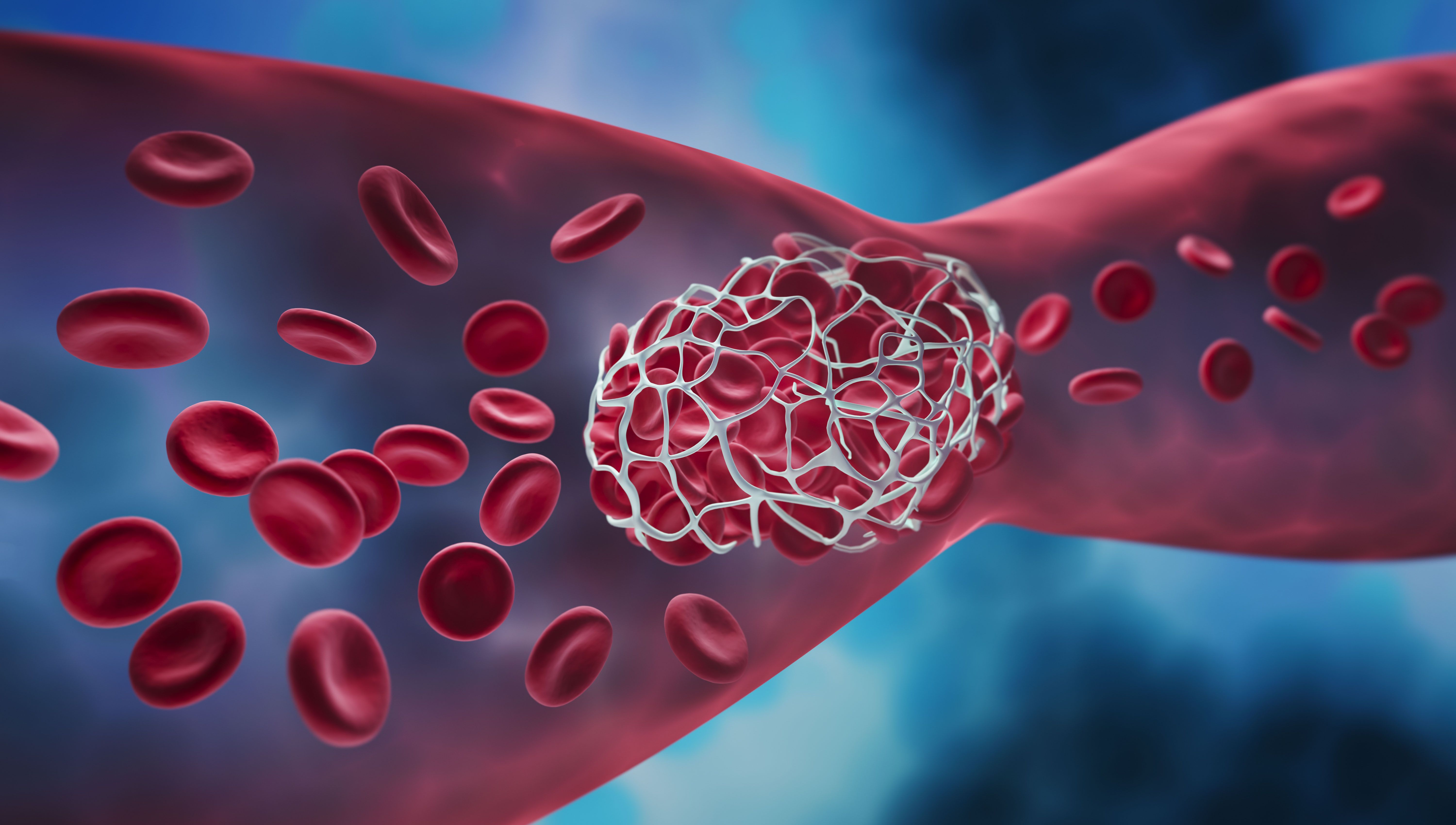 Study Thrombotic Events Increase Mortality Risk for People With