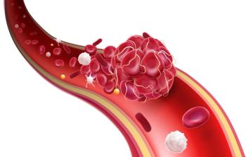 medical illustration of a blood clot | image credit: ©Anucha