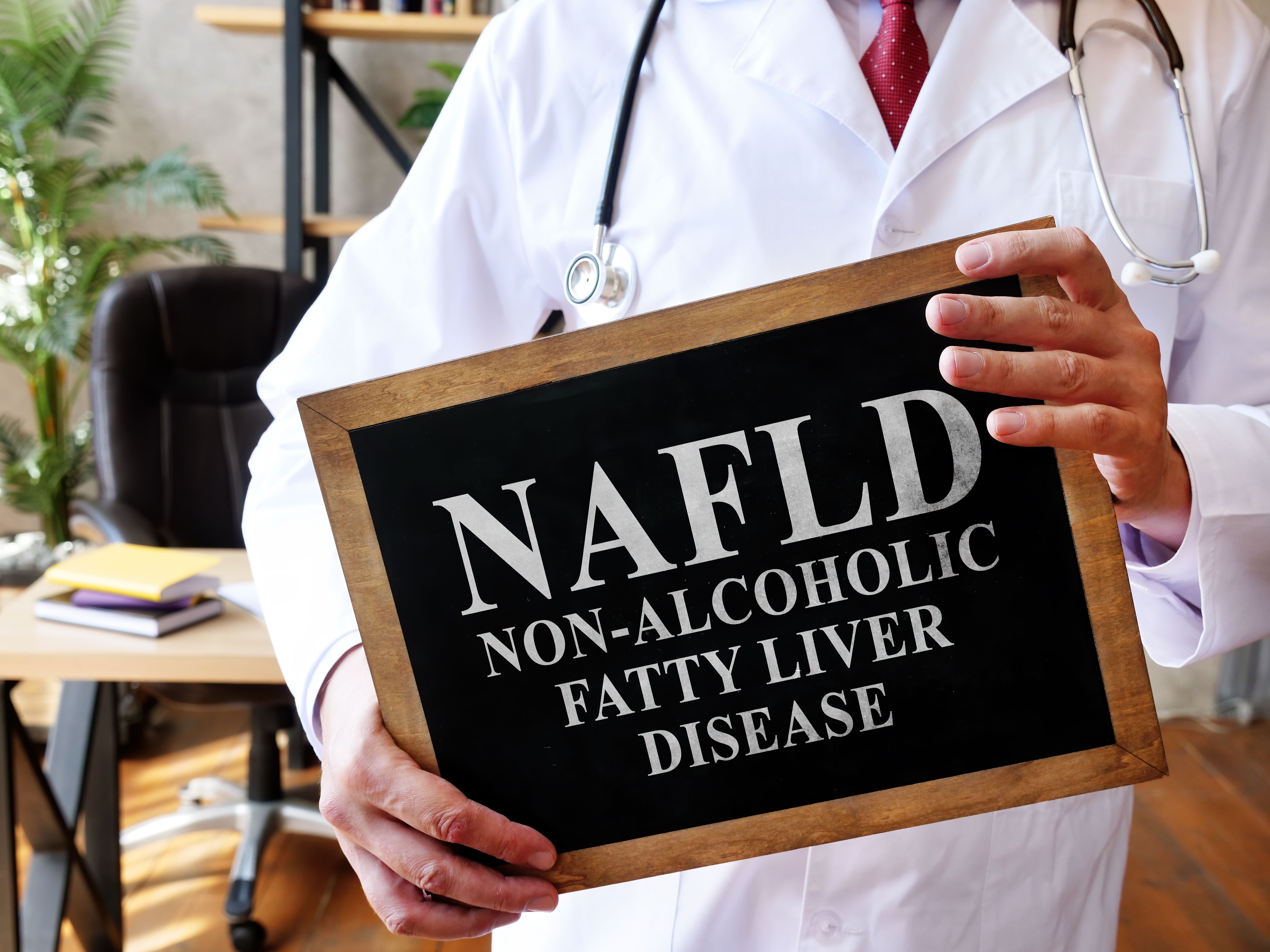 Non alcoholic fatty liver disease