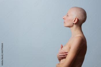 woman with a shaved after a mastectomy | Image credit: ©Sergey Novikov stock.adobe.com