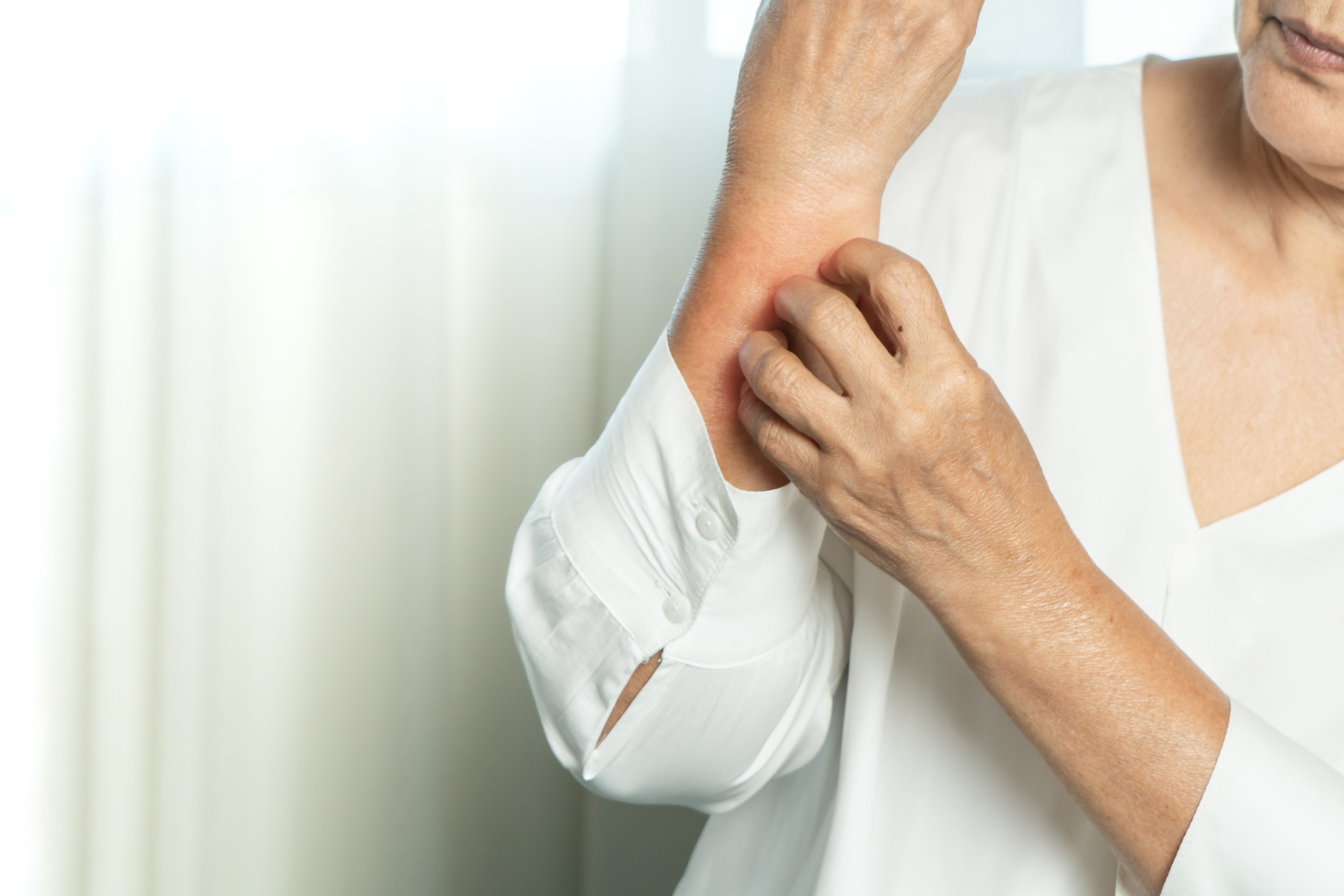 Phase 3 Trial Points to Successful Treatment of Itch-Causing Condition ...