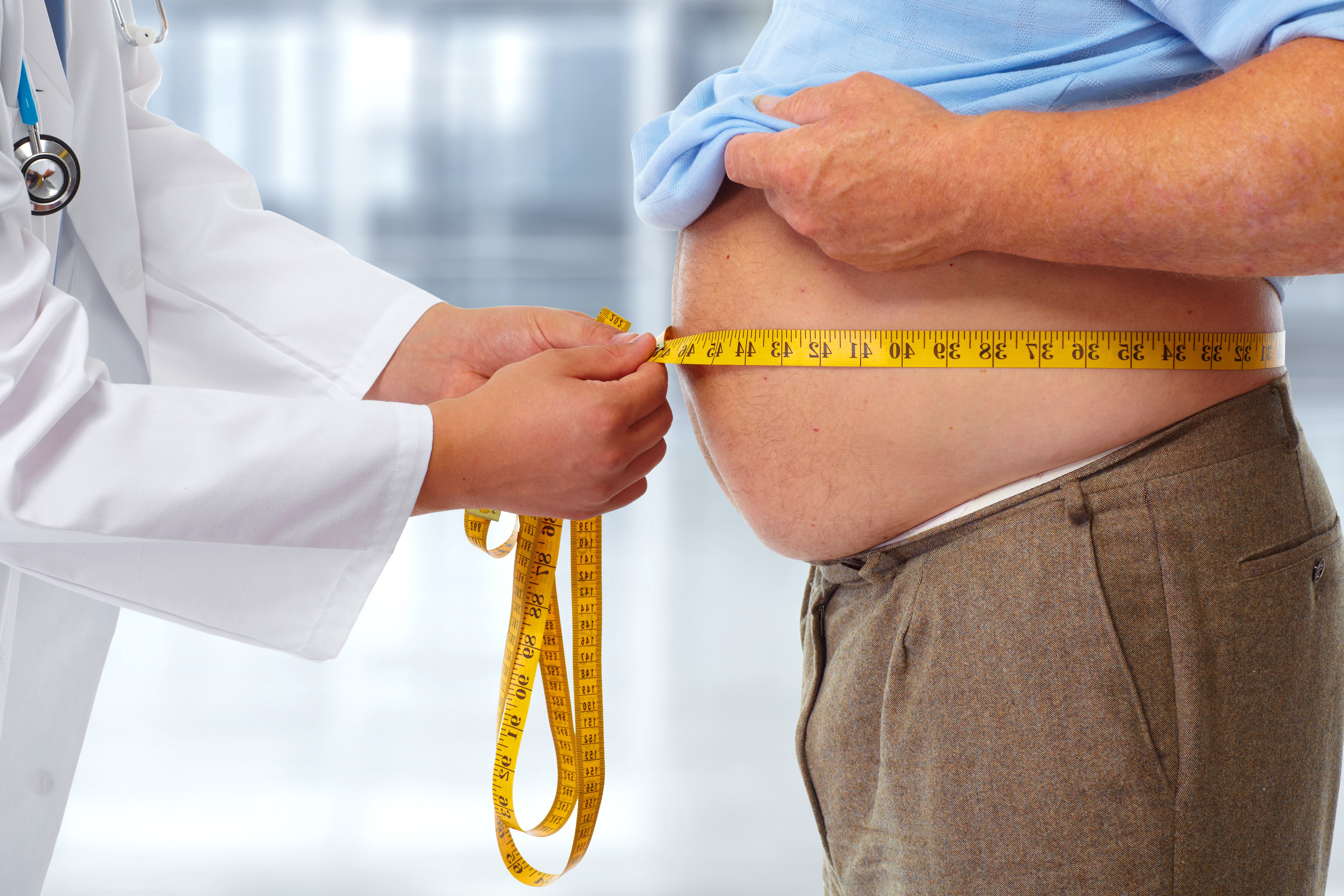 Увеличение веса заболевание. Ожирение. Лишний вес. Избыточная масса тела.