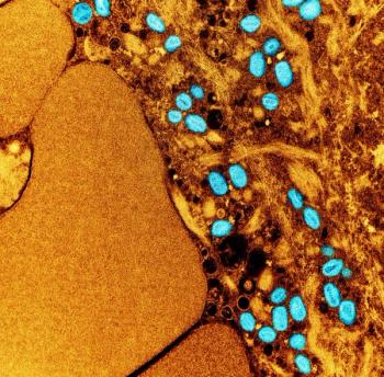 Credit: CDC/ National Institute of Allergy and Infectious Diseases (NIAID)