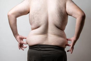 back view of an obese man | image credit: ©ardasavasciogullari stock.adobe.com