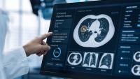How do patients respond to lung cancer screening false positives? | CHEST 2026