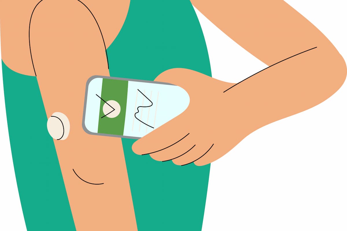 CONNECT data support CGM use in non-insulin type 2 diabetes management ...