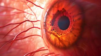 front of eye reddish color illustration of diabetic retinopathy | Image credit ©ramzan stock.adobe.com