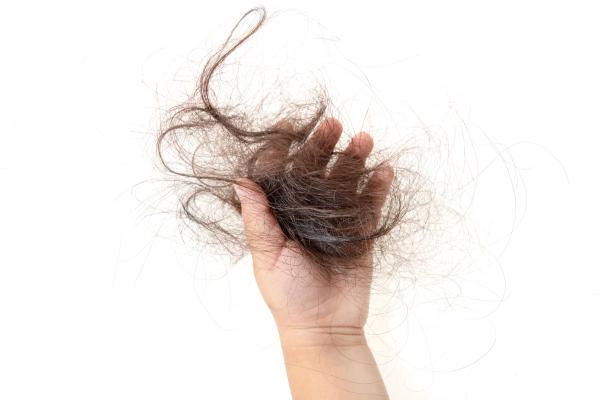 Almost Half of Severe Alopecia Areata Pediatric Patients Saw Hair Regrowth on Olumiant, Study Shows | 2025 Fall Clinical Derm