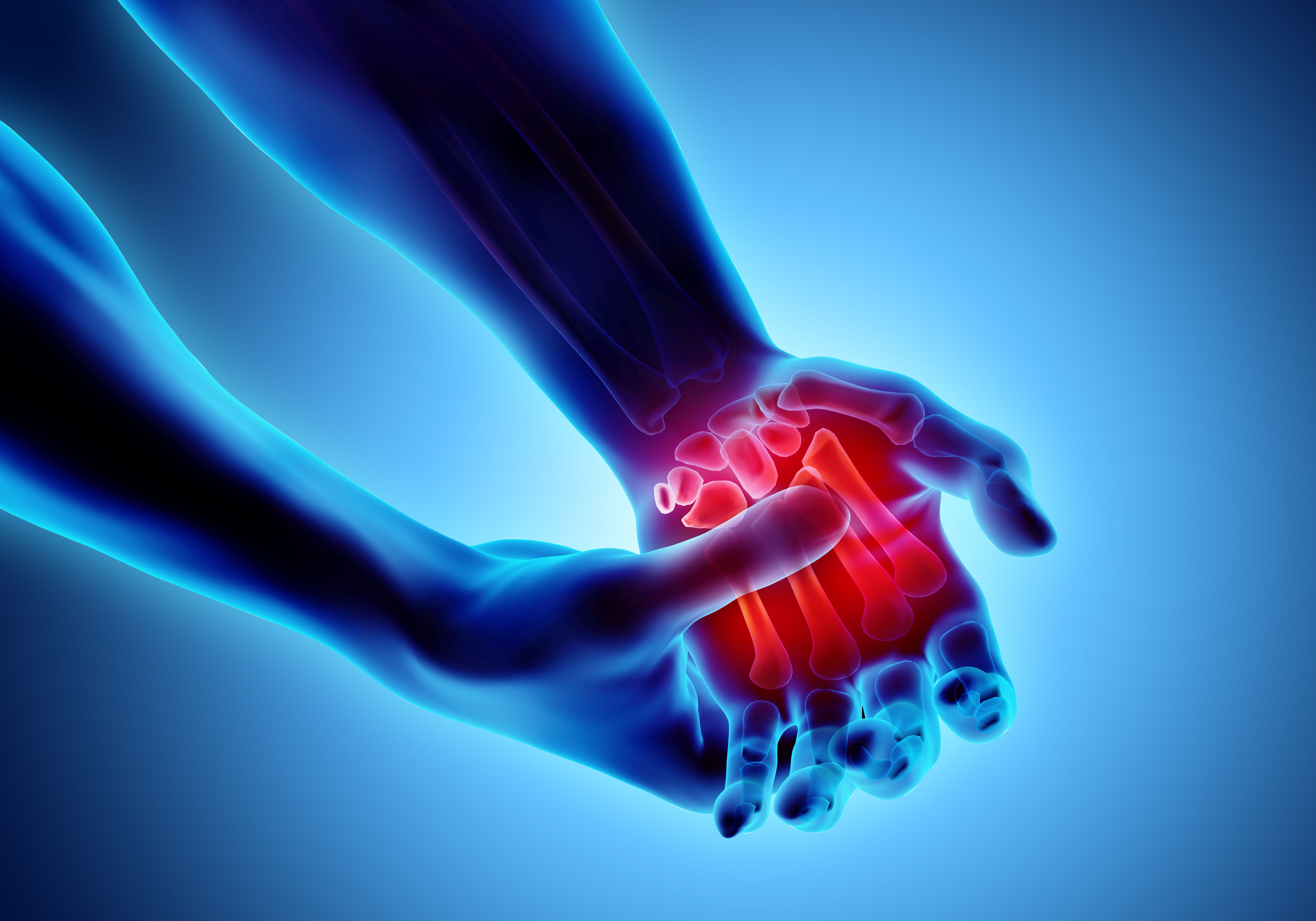 glp 1 rheumatoid arthritis GLP-1s Improve Rheumatoid Arthritis Symptoms, Study Suggests