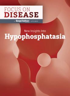 New Insights Into Hypophosphatasia