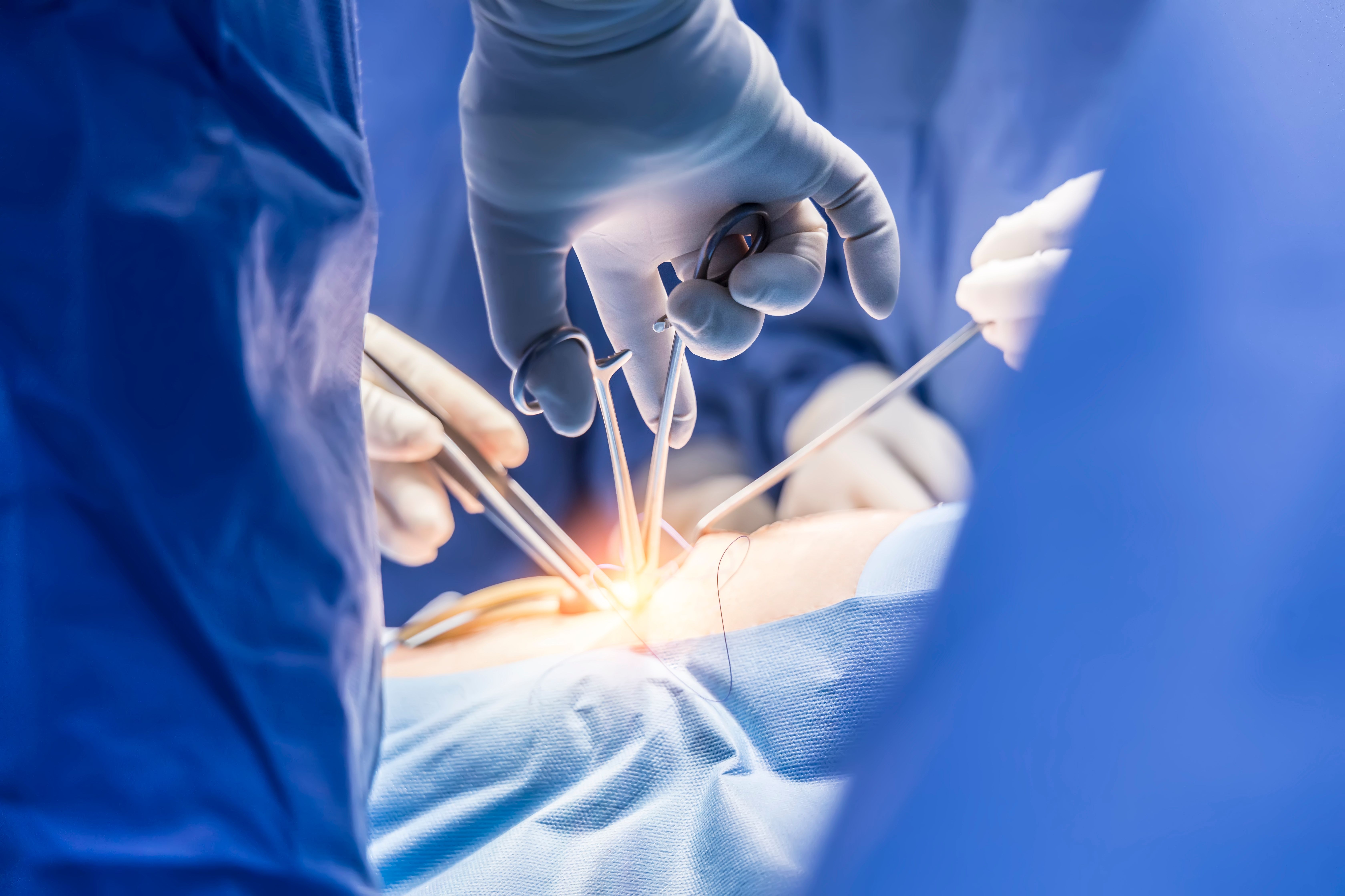 Investigational non-opioid LTG-001 reduced acute pain in phase 2b trial