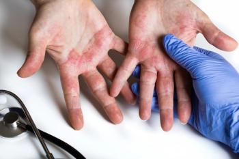red hands, White person, with blue gloved hand and a stethoscope in corner of image  | ©Rochu_2008
