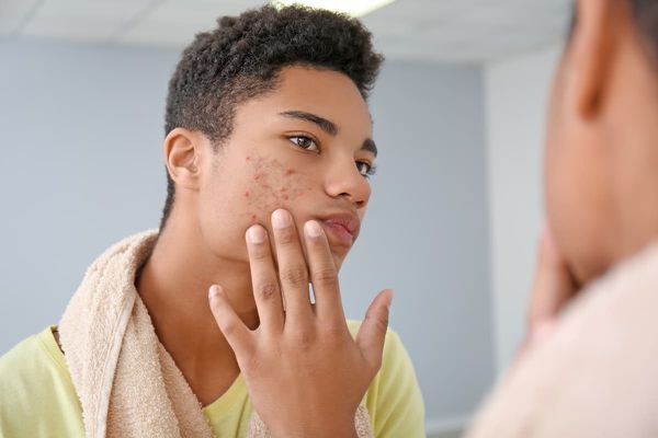 Make lab monitoring of patents taking isotretinoin less routine, more based on symptoms