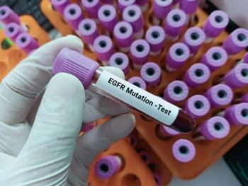 hand wearing a white glove holding test tube that says EGFR mutation test | ©innovative creation stock.adobe.com