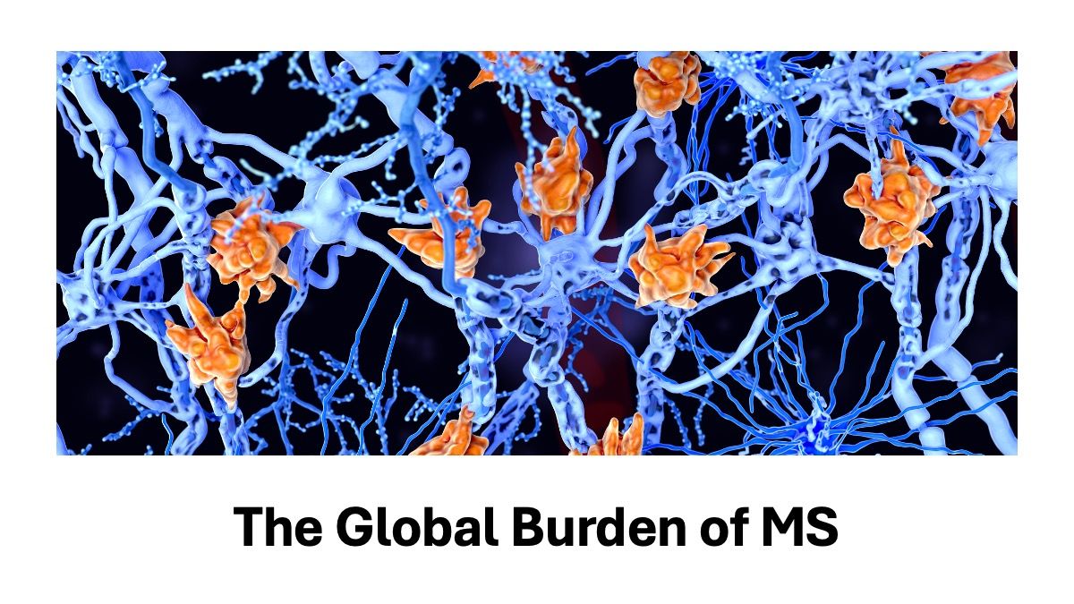 <![CDATA[Global MS analysis links disability burden to rising economic strain]]>