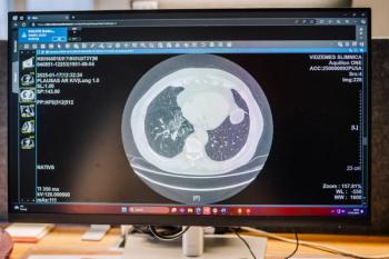 Computer screen displaying a CT scan image of lungs | image credit: ©Ravio stock.adobe.com