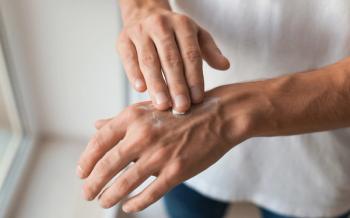 man applying hand cream | Image credit: Africa Studio - stock.adobe.com