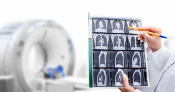 Radiologist showing black and white scan of a patient's lungs over of CT machine | ©peakstock stock.adobe.com
