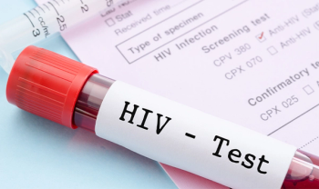 HIV test