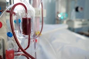 close up of dialysis machine | Image credit: ©Kiryl Lis  stock.adobe,.com