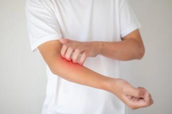 young person scratching skin that is red | Image credit: Kwangmooza stock.adobe.com