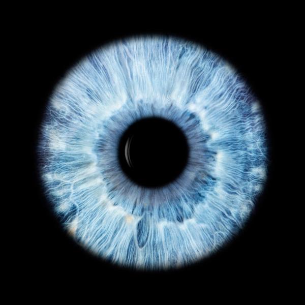 Iris photography helps separate pigment from pathology, ophthalmic imager says | AAO 2026