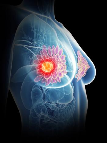 3d image of breast | Image credit: © SciePro stock.adobe.com