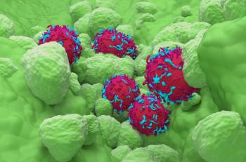 close-up of non-small lung cancer cells colored red | image credit: ©laszlo stock.adobe.com