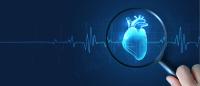 Heart data in sleep study predicts atrial fibrillation, heart failure years in advance