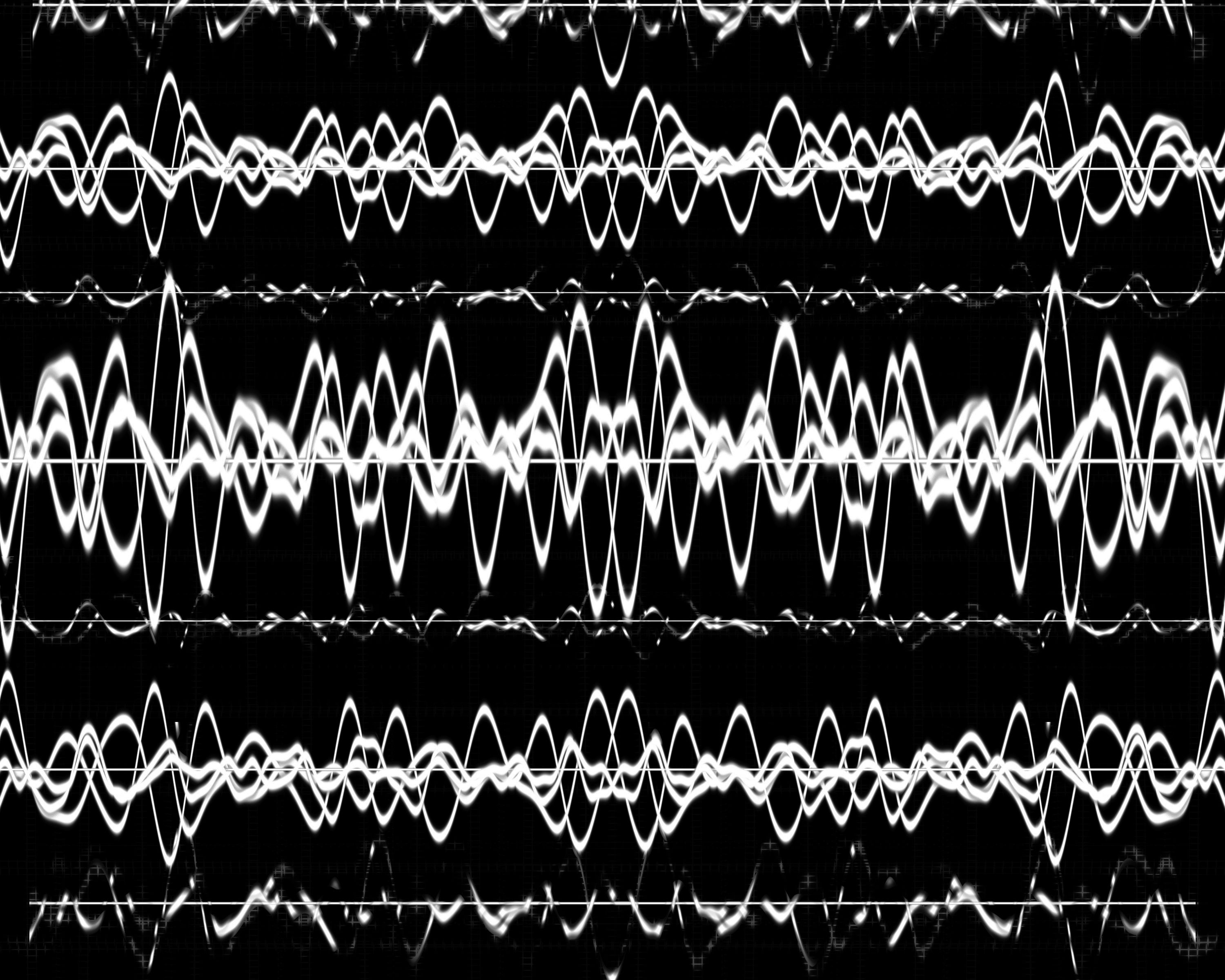 REM Density Could Be Potent Biomarker, Investigators Argue