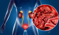 Overlooked bladder nerves now thought to reduce UTI burden through pain signaling, study shows