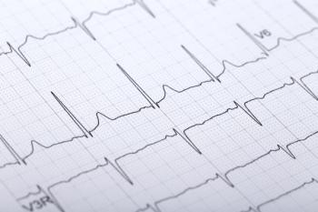 ECG | ©Yan stock.adobe.com