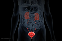 Researchers highlight DR-70 as a possible biomarker for early bladder cancer detection