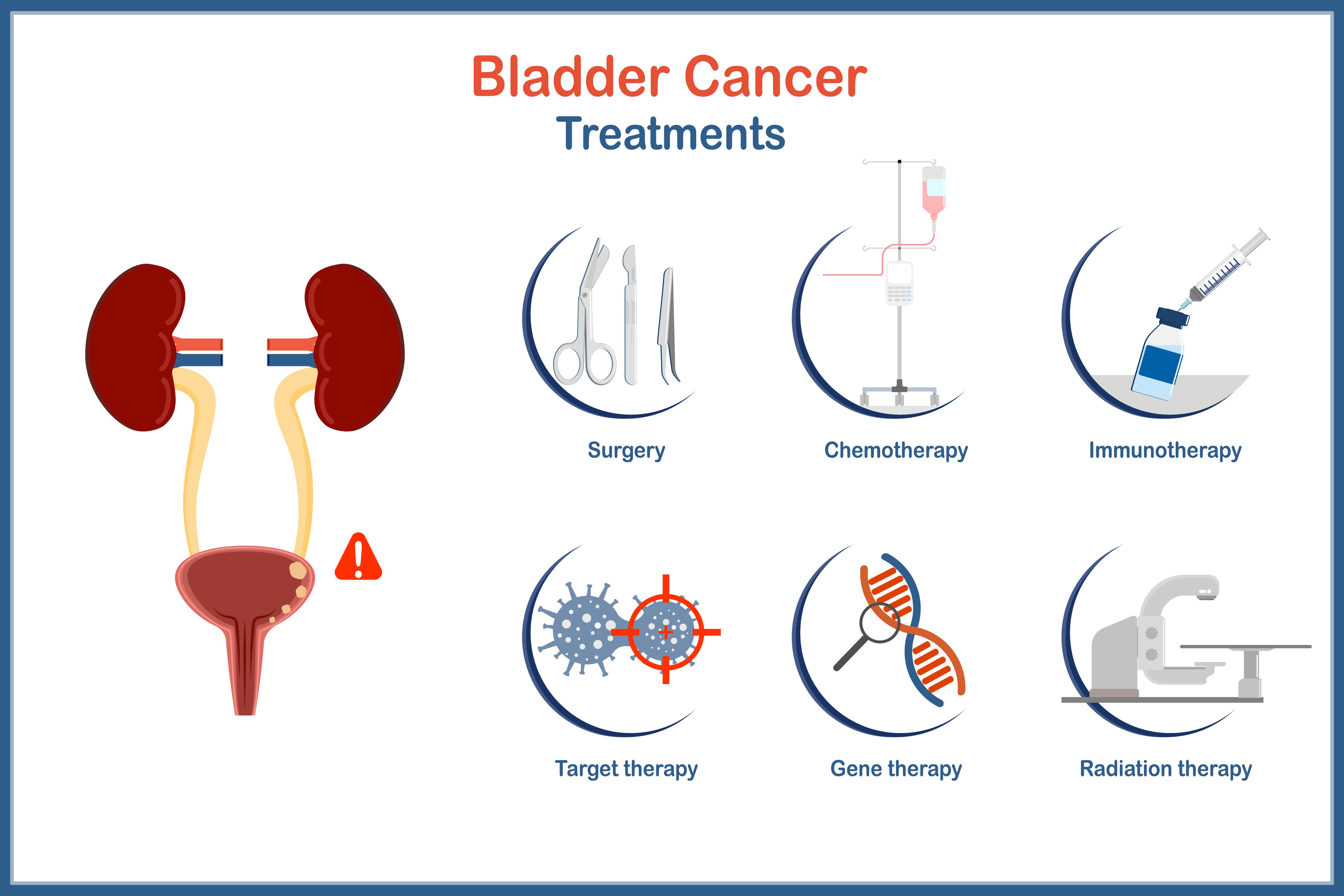 illustration showing six different treatments for bladder cancer | ©weerasak stock.adobe.com