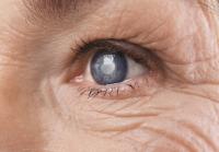 Many inherited eye disease genes rarely cause vision loss, study found