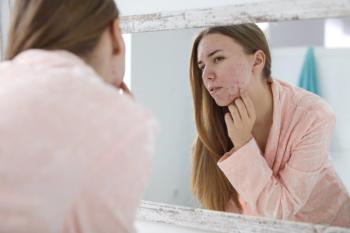Oral acne drug denifanstat shows deeper results through 52 weeks | 2026 Fall Clinical Derm