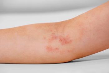8 dermatology developments from 2026 that experts say matter most | 2026 Fall Clinical Derm 