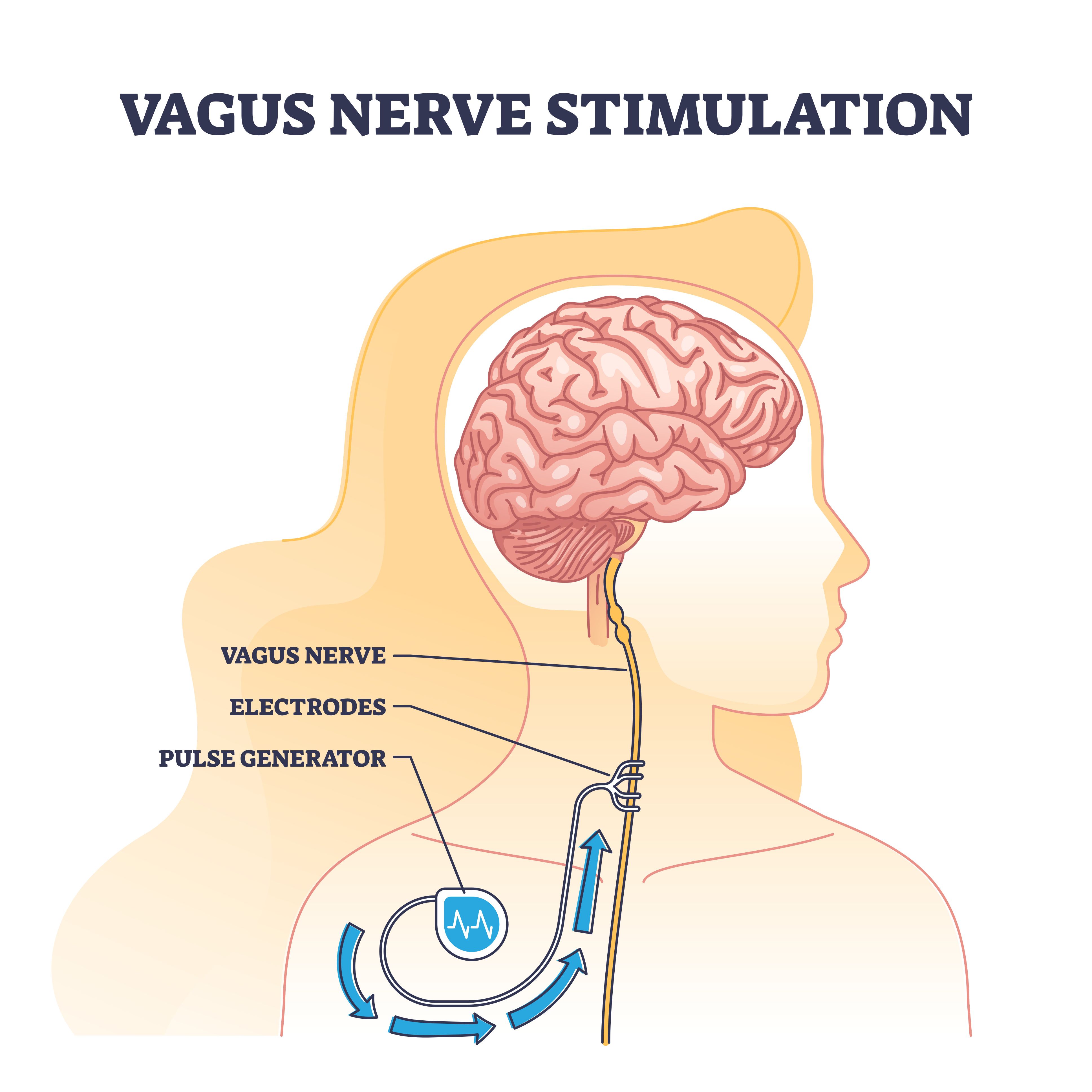 Vagus Example Vagus Nerve