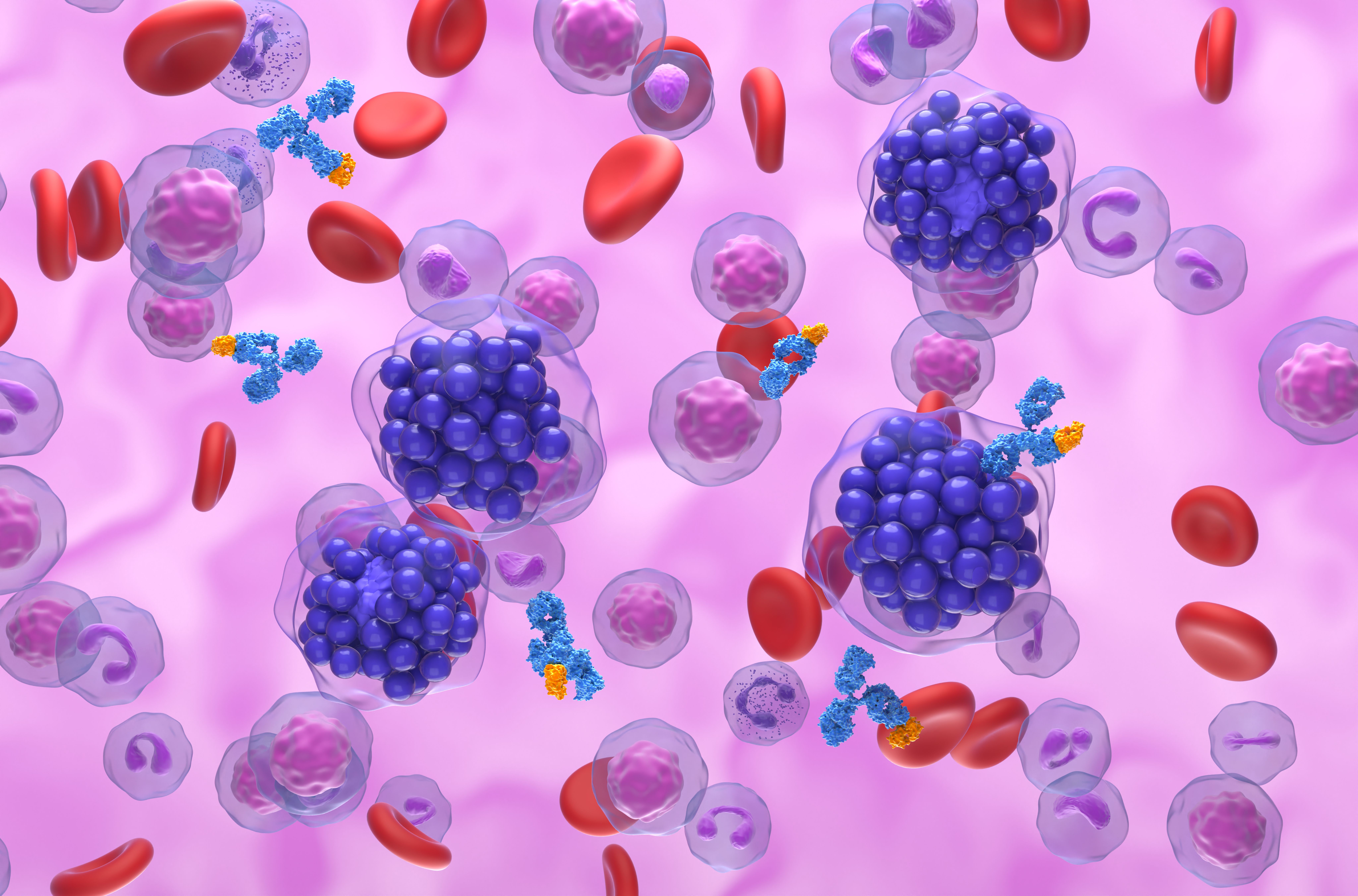 lymphoma © LASZLO - stock.adobe.com