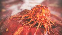 New AACR report has found U.S. Cancer death rate dropped 35% since 1991