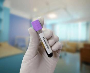 white gloved holding a test tube that says KRAS mutation | ©innovative creation stock.adobe.com