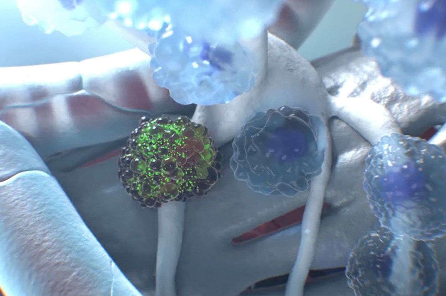 Nanoparticle Therapy has Potential to Reprogram the Immune System in Type 1 Diabetes Nanoparticle Therapy has Potential to Reprogram the Immune System in Type 1 Diabetes